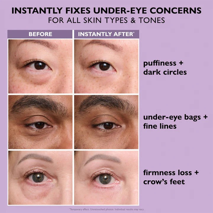 Instant Eye Tightener with Brush - Eye Bag Tightener, Dark Circles Remover, Reduce Fine Lines and Wrinkles